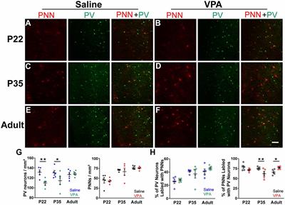 Altered Relationship Between Parvalbumin and Perineuronal Nets in an Autism Model